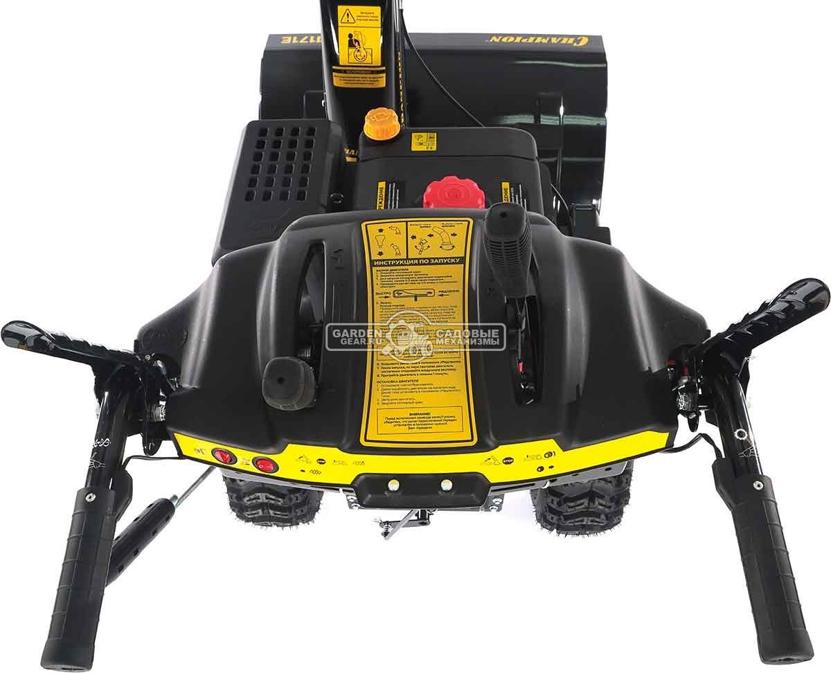 Снегоуборщик Champion ST1171E (PRC, 70 см., Champion, 375 см3,  эл/стартер 220В, фара, автоматический дифференциал, 123.5 кг)